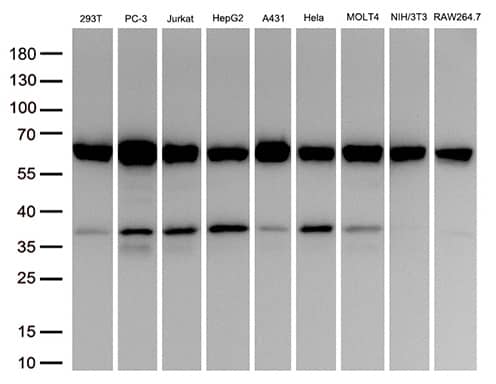 PPP3CB Antibody (OTI2E4)