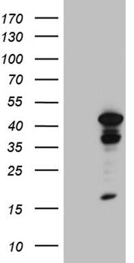 TIN2 Antibody (OTI2C12) Western Blot;TIN2 Antibody (OTI2C12)[NBP3-45024]-