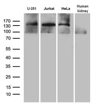 SUPT16H Antibody (OTI8A1)