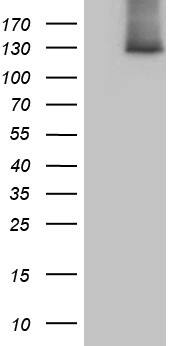 SUPT16H Antibody (OTI8A1) Western Blot;SUPT16H Antibody (OTI8A1)[NBP3-45025]-