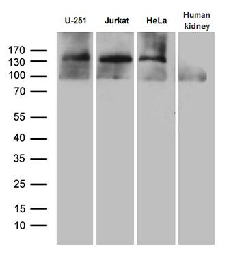 SUPT16H Antibody (OTI8A1) Western Blot;SUPT16H Antibody (OTI8A1)[NBP3-45025]-