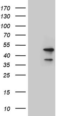 LSM11 Antibody (OTI1H1) Western Blot;LSM11 Antibody (OTI1H1)[NBP3-45040]-