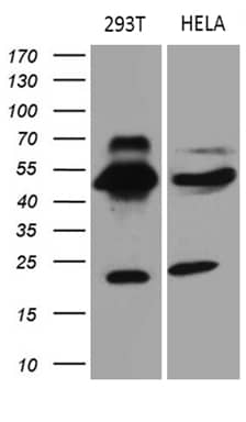 TEKT2 Antibody (OTI1E6) Western Blot;TEKT2 Antibody (OTI1E6)[NBP3-45042]-