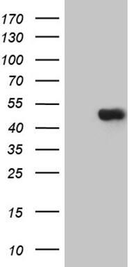 TEKT2 Antibody (OTI1E6) Western Blot;TEKT2 Antibody (OTI1E6)[NBP3-45042]-