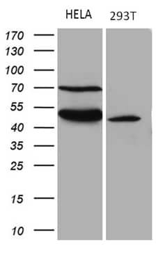 TEKT2 Antibody (OTI1E11) Western Blot;TEKT2 Antibody (OTI1E11)[NBP3-45043]-