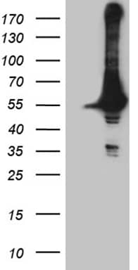 DDX19A Antibody (OTI3C12)