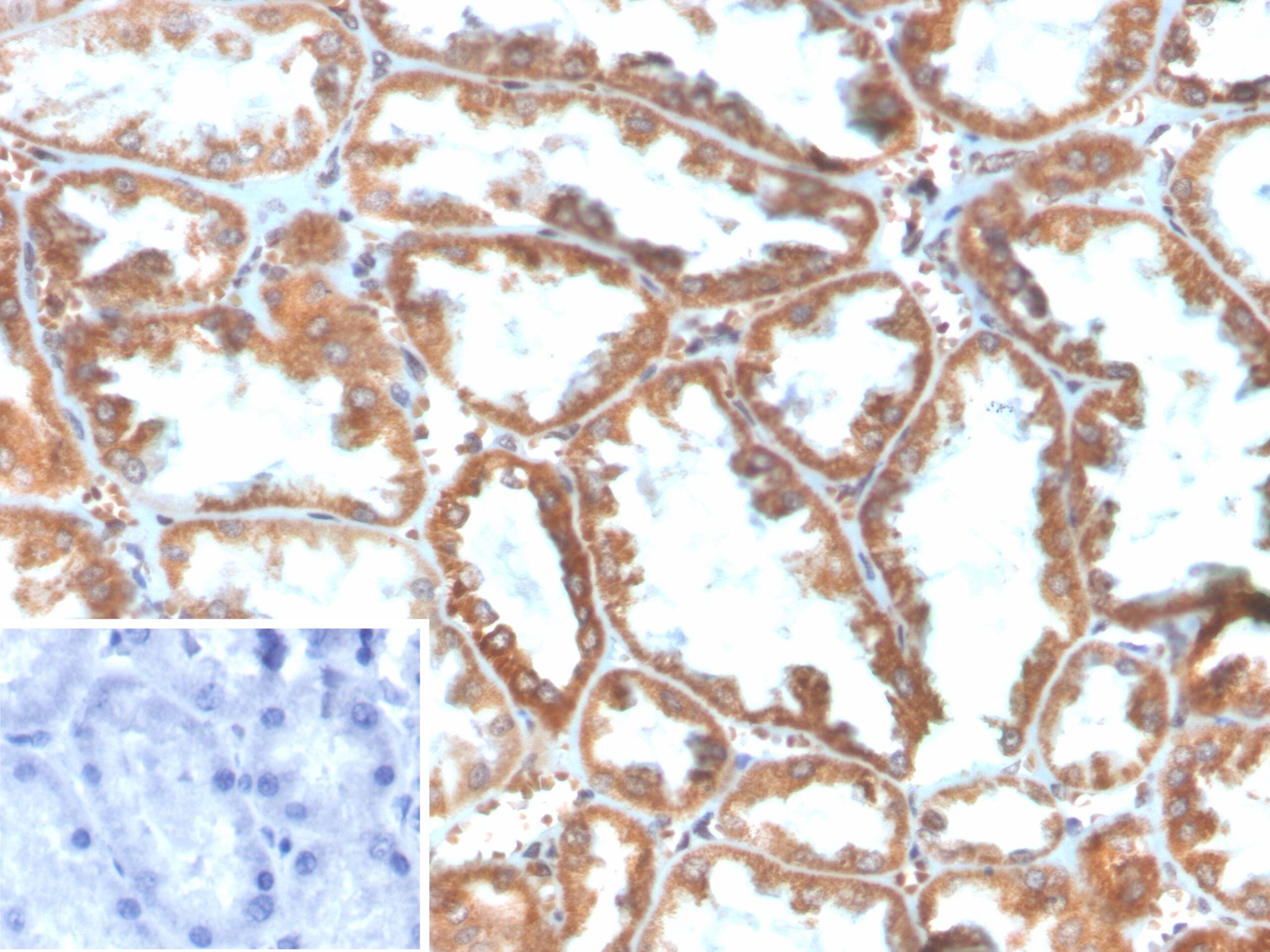 PLA2R1 Antibody (PLA2R1/4897) - Azide and BSA Free