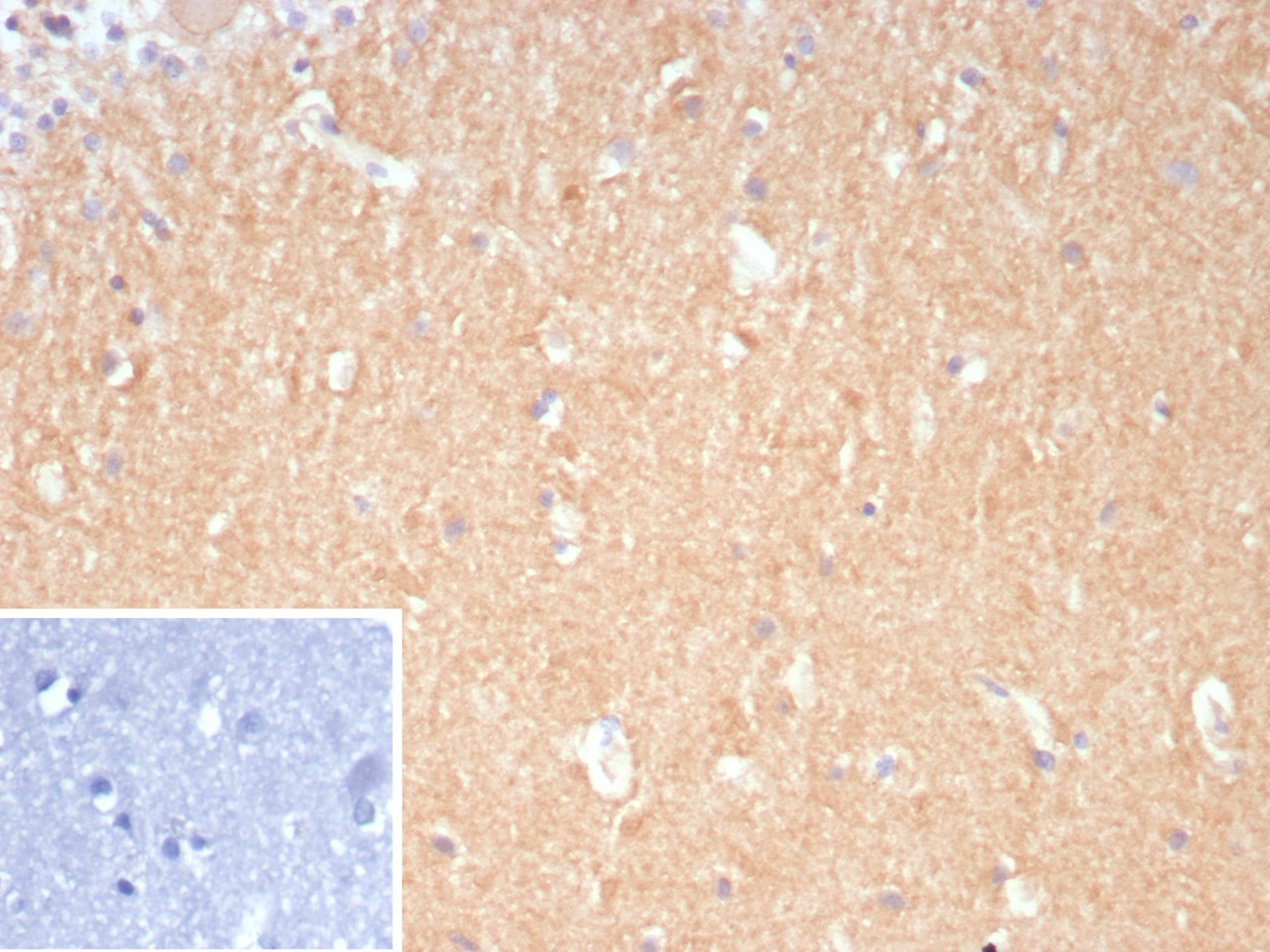 DLL3 Antibody (DLL3/9361) - Azide and BSA Free
