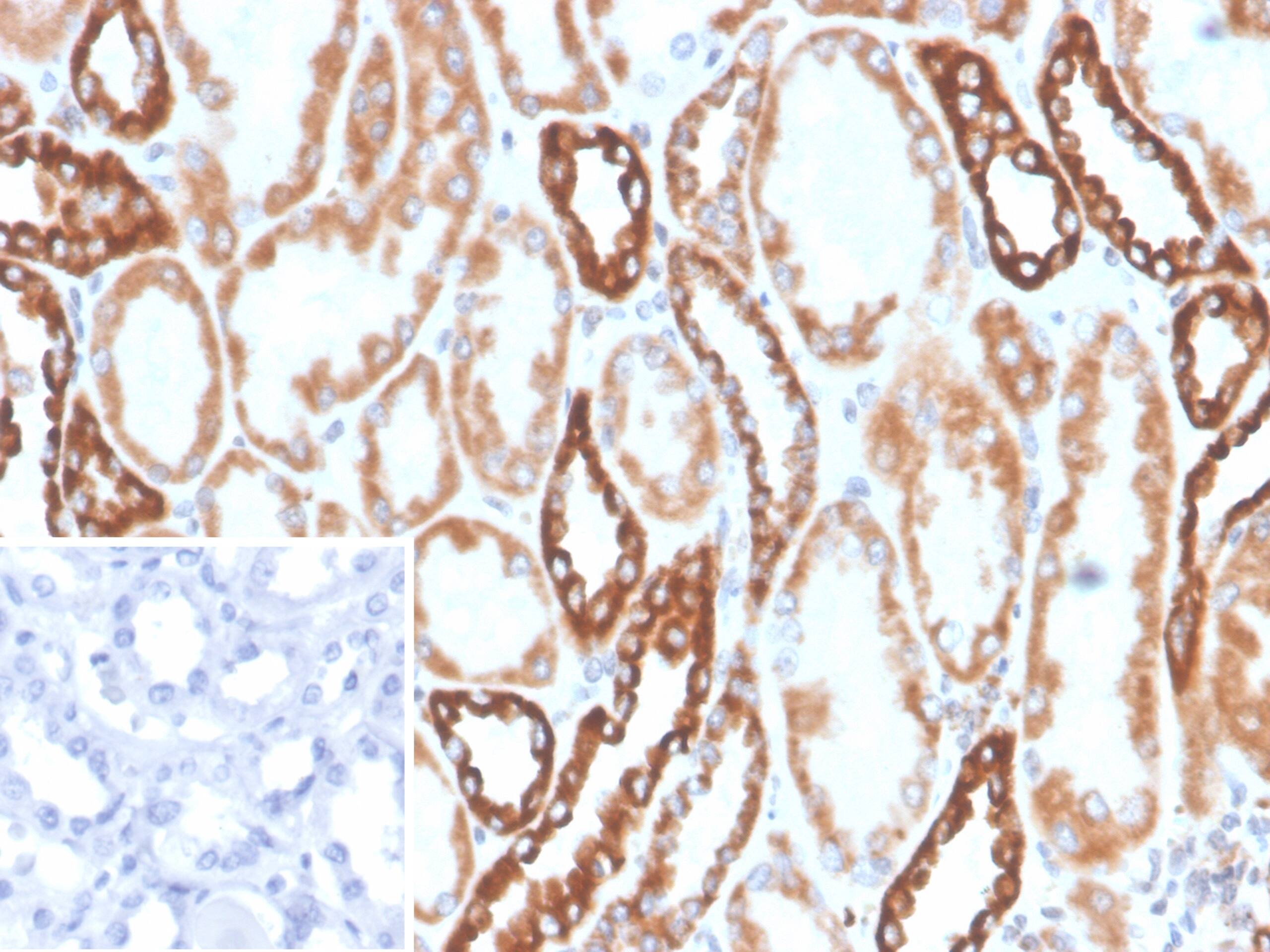 PLA2R1 Antibody (PLA2R1/4894) - Azide and BSA Free