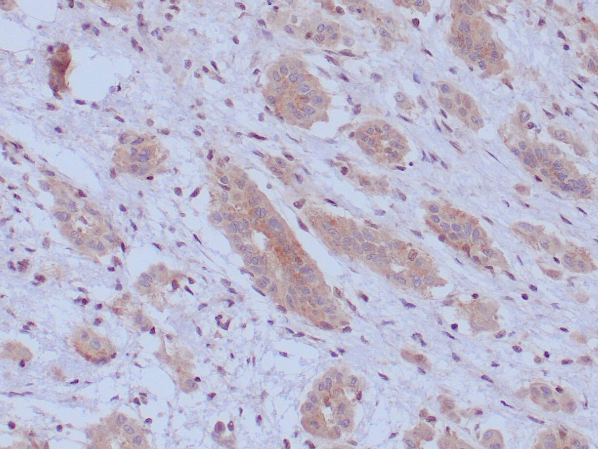 BAP1 Antibody (BAP1/9795R) - Azide and BSA Free