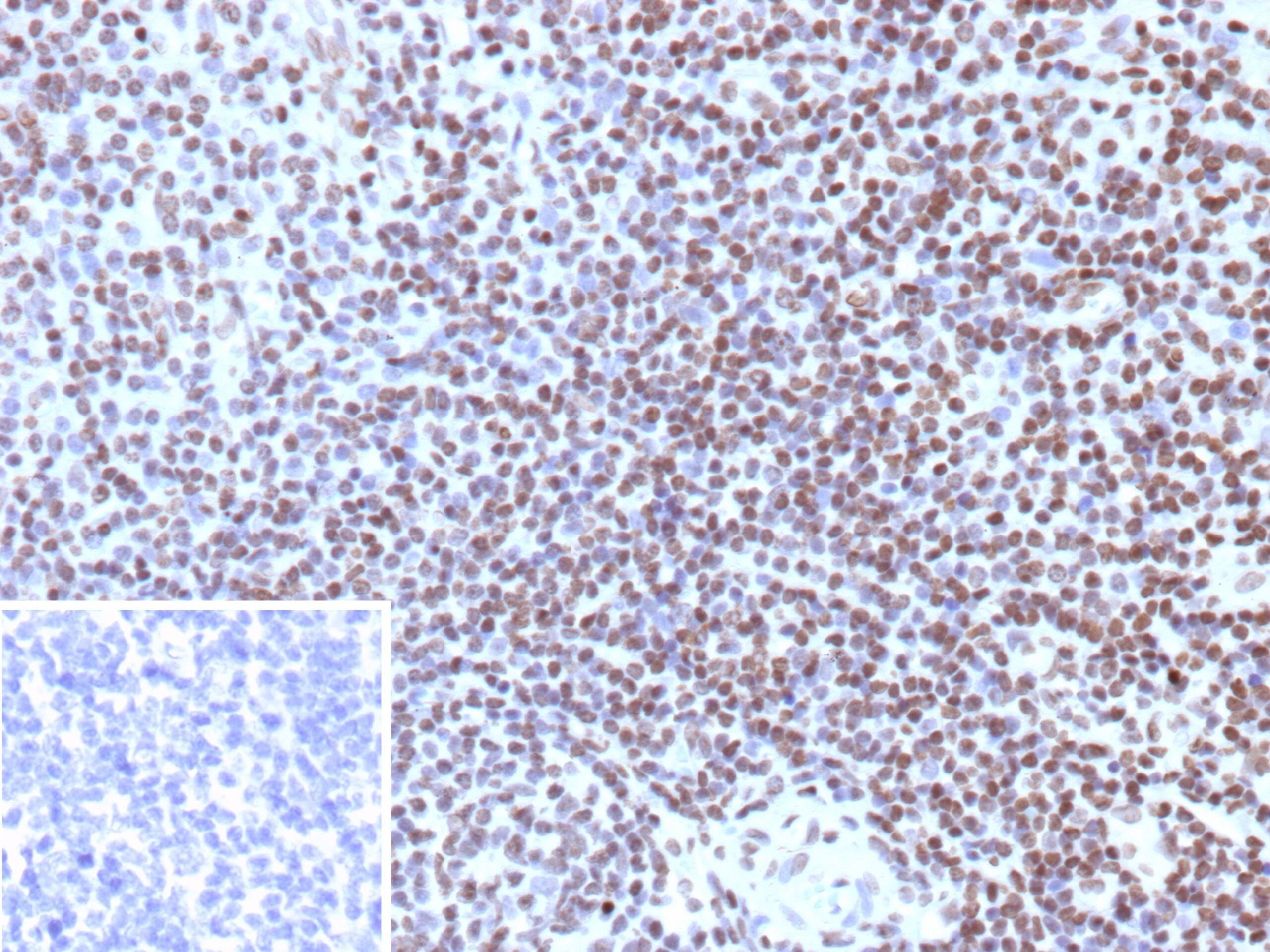 Histone H3.1 [p Ser10] Antibody (rHH3/9924) - Azide and BSA Free