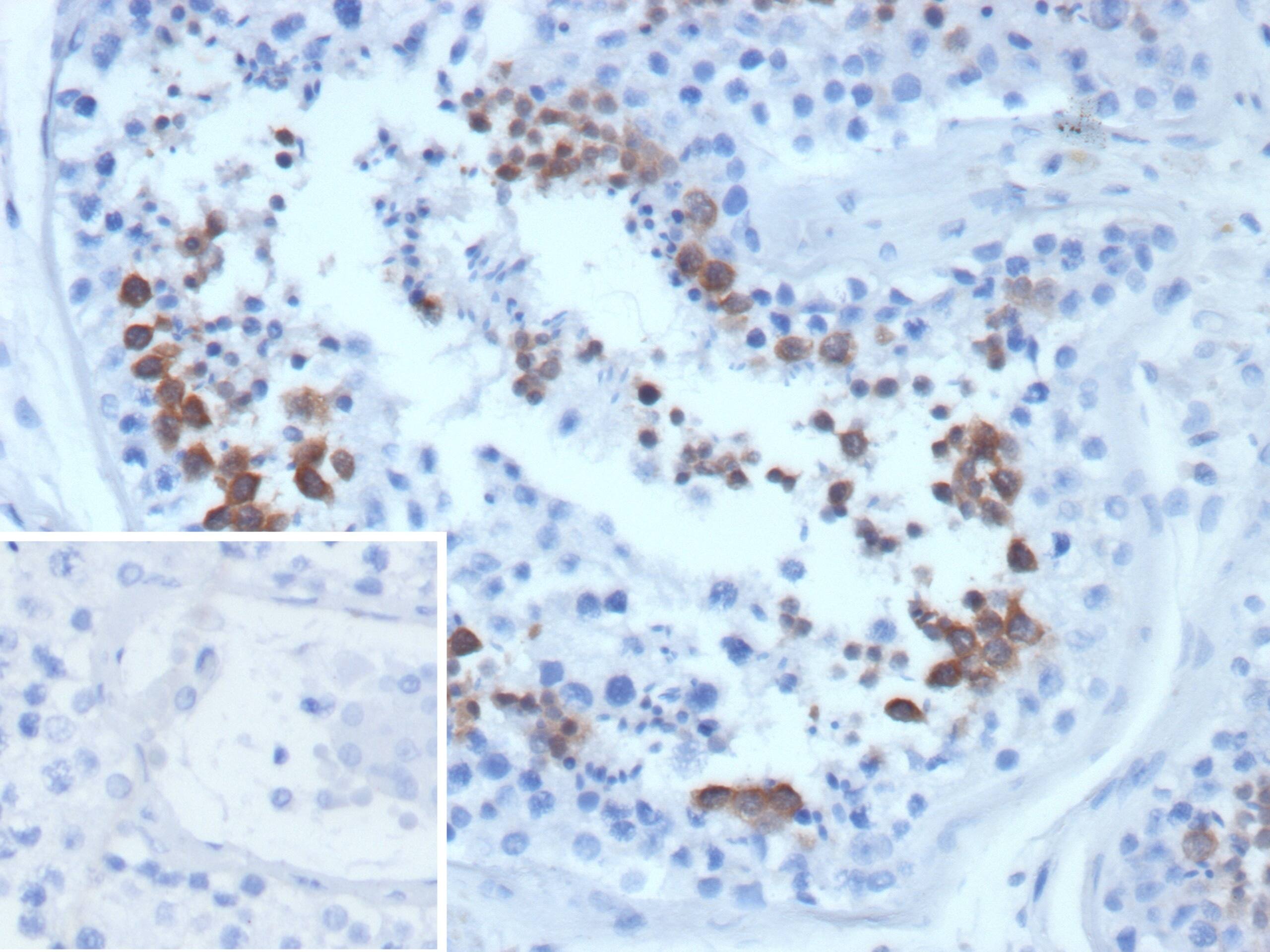 Centrin 1 Antibody (CETN1/9877) - Azide and BSA Free