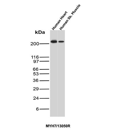 MYH7 Antibody (MYH7/13050R) - Azide and BSA Free