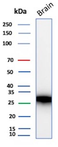 Calbindin D-28K Antibody (rCALB1/13280) - Azide and BSA Free