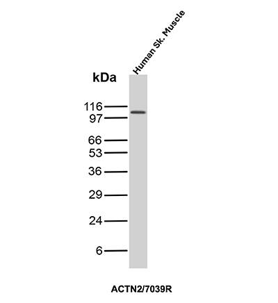 Alpha Actinin 2 Antibody (ACTN2/7039R) - Azide and BSA Free