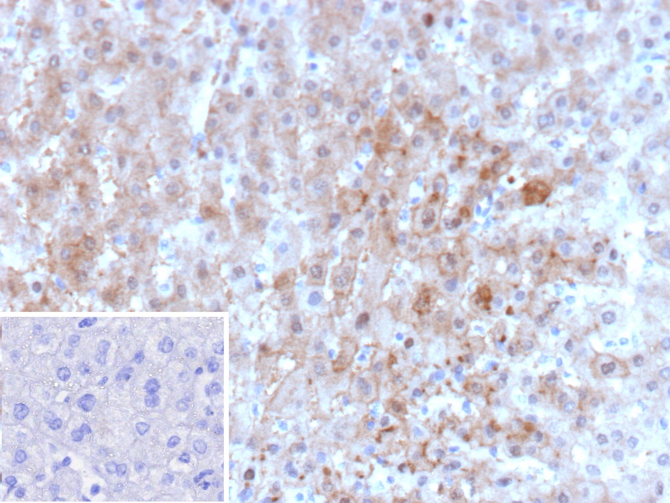 Aldo-keto Reductase 1C1/AKR1C1 Antibody (AKR1C1/9062) - Azide and BSA Free
