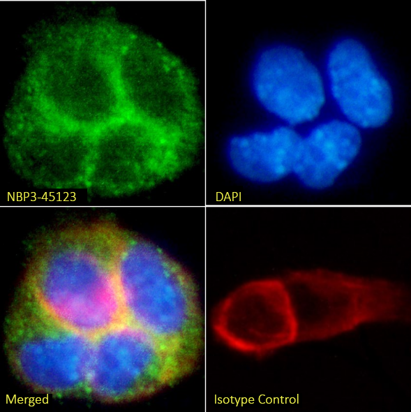 5T4 Antibody (39A11G5F2) - Chimeric - BSA Free 5T4 Antibody (39A11G5F2) - Chimeric - BSA Free