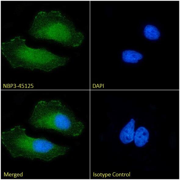 p16INK4a/CDKN2A Antibody (30859-S17) - Chimeric - BSA Free p16INK4a/CDKN2A Antibody (30859-S17) - Chimeric - BSA Free