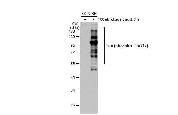 Tau [p Thr217] Antibody (HL1276) - Azide and BSA Free