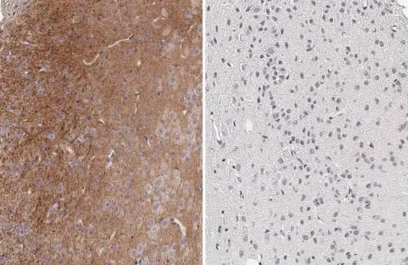 Tau [p Thr181] Antibody (HL2497) - Azide and BSA Free