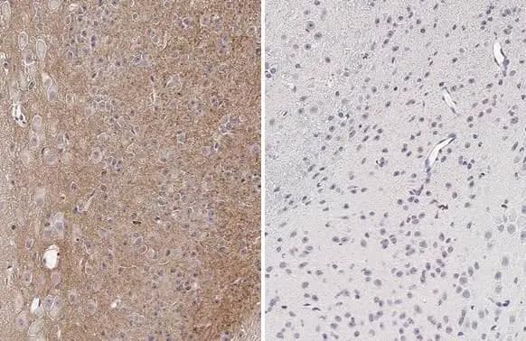 Tau [p Thr181] Antibody (HL2498) - Azide and BSA Free