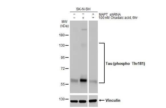 Tau [p Thr181] Antibody (HL2498) - Azide and BSA Free
