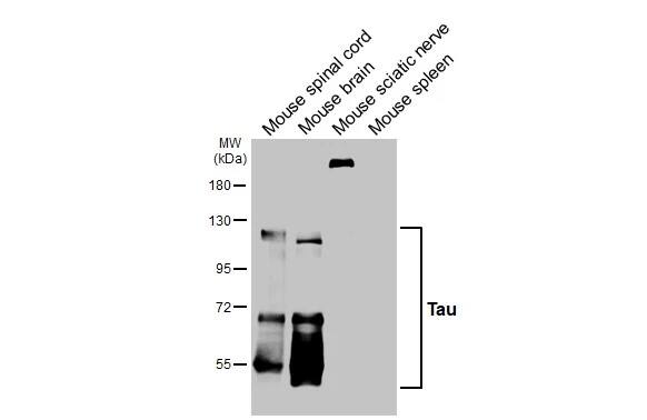 Tau Antibody (HL2802) - Azide and BSA Free