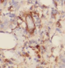 TOMM6 Antibody - BSA Free