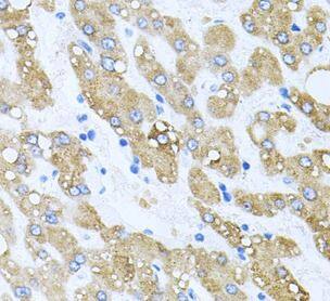 TOB2 Antibody - BSA Free