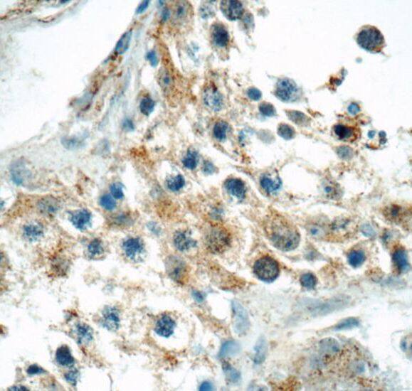 TNRC4 Antibody - BSA Free
