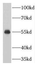 TNRC4 Antibody - BSA Free