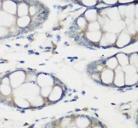 TNNC2 Antibody - BSA Free