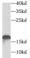 TNNC2 Antibody - BSA Free