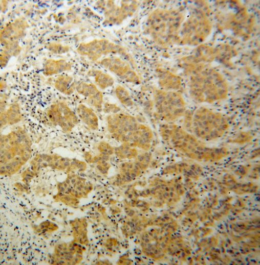 Tnk1 Antibody - BSA Free