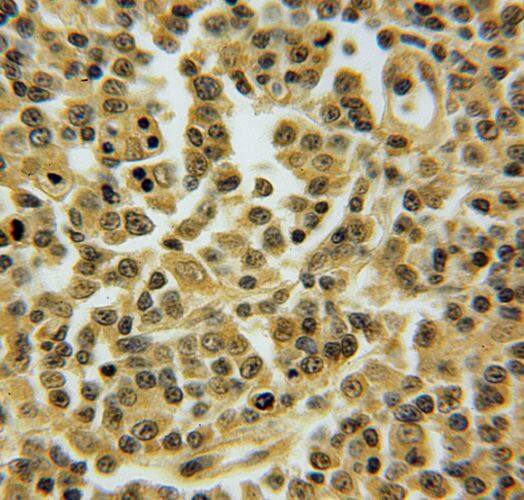 TNFAIP8L2 Antibody - BSA Free