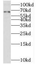 TXNDC10 Antibody - BSA Free