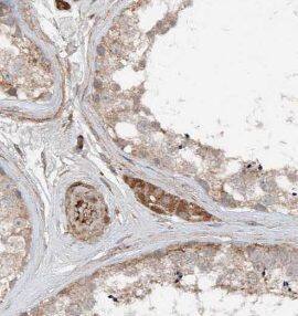 TXNDC10 Antibody - BSA Free