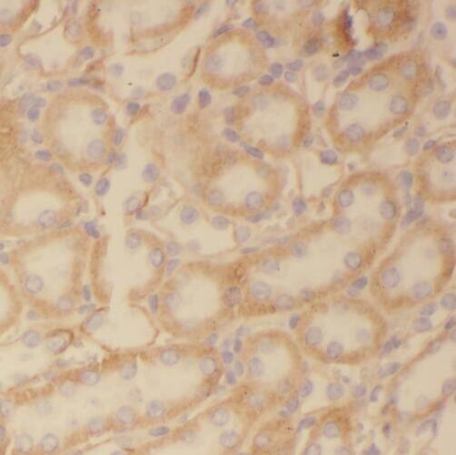 TMX2 Antibody - BSA Free