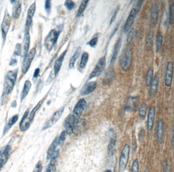 TMPRSS3 Antibody - BSA Free