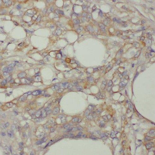 TMEM9B Antibody - BSA Free