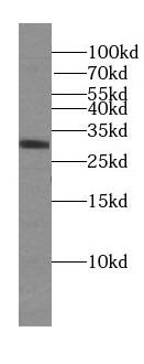 DRAM2 Antibody - BSA Free