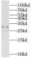 TMEM55B Antibody - BSA Free