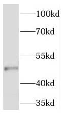 TMEM5 Antibody - BSA Free