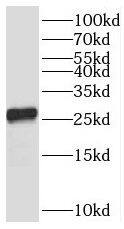 TMEM41A Antibody - BSA Free