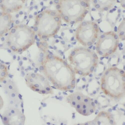 TMEM38B Antibody - BSA Free