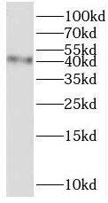 TMEM38B Antibody - BSA Free