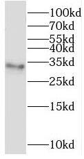 TMEM38A Antibody - BSA Free