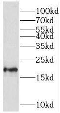 TMEM35 Antibody - BSA Free