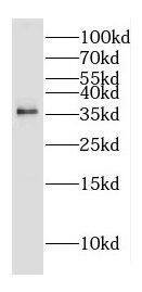 DOK5 Antibody - BSA Free