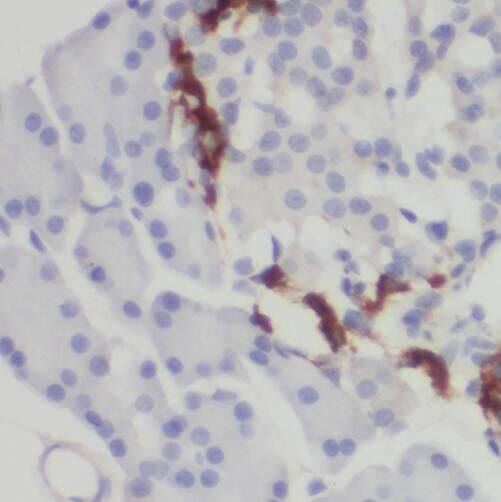 TMEM231 Antibody - BSA Free